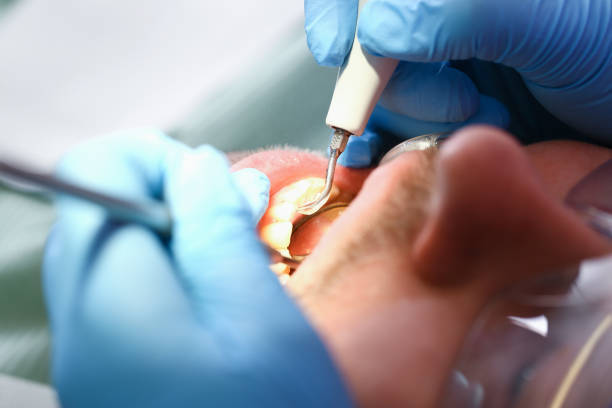 Best Emergency Care for Gum Disease in Leisure Knoll, NJ