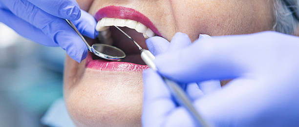 Best Broken or Chipped Tooth Repair in Leisure Knoll, NJ